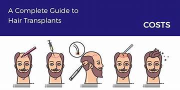 Comprehensive Guide To Hair Transplants: Benefits, Procedure, And Costs