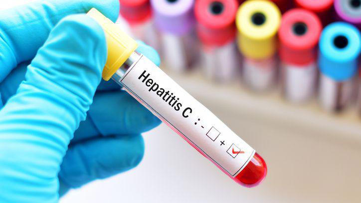 Hepatitis C