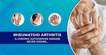 Rheumatoid Arthritis (ra)