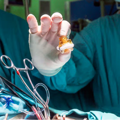 Heart Double Valve Replacement
