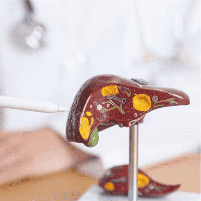 Liver Transplant in India