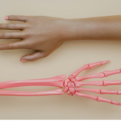 Bone Marrow Transplant