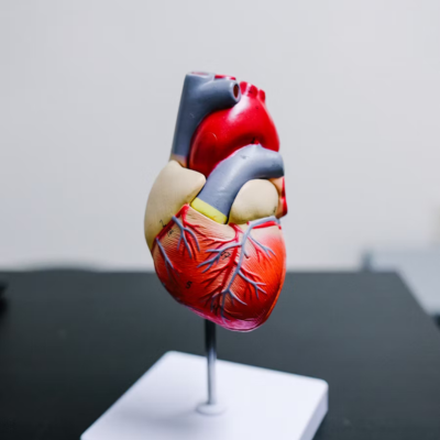 Heart Bypass Surgery