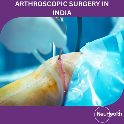 Arthroscopic Surgery