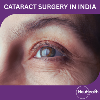 Cataract Surgery