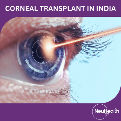 Corneal Transplant