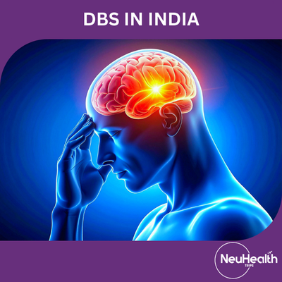 Deep Brain Stimulation (DBS)