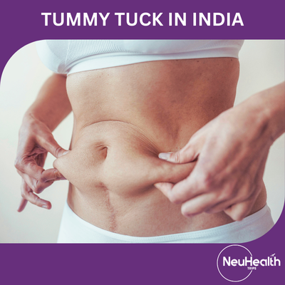 Tummy Tuck