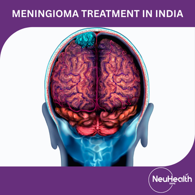 Meningioma Treatment