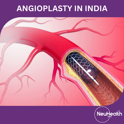 Angioplasty