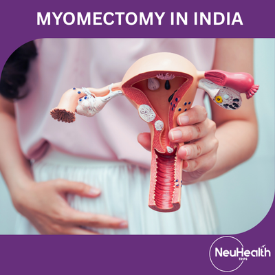 Myomectomy