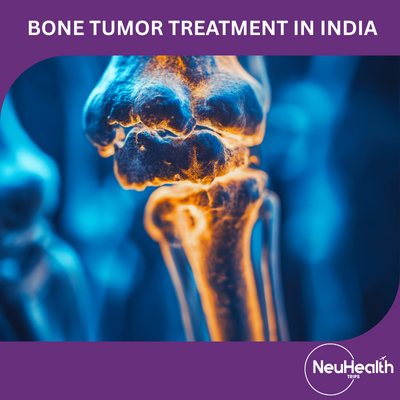 Bone Tumor Treatment