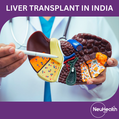 Liver Transplant