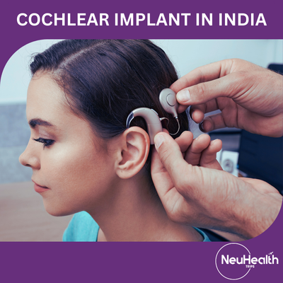 Cochlear Implant