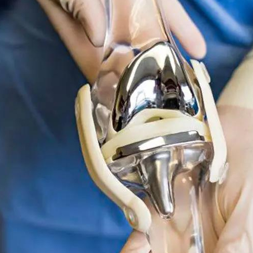 Knee Replacement